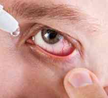 Roșeața ochilor și inflamația: cauze și simptome, tratament