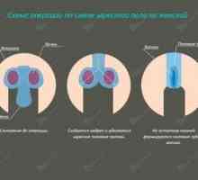 Consecințele unei operații de a schimba organele genitale