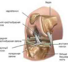 Deteriorarea la meniscul articulației genunchiului: simptome și tratament