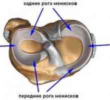 Deteriorarea și tratamentul meniscului medial al articulației genunchiului