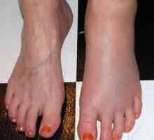 Cauze ale durerii piciorului: tipuri de boli și tratament