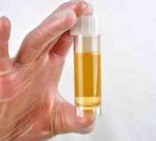 Cauzele urinei tulbure la bărbați și femei