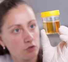 Cauzele apariției mucusului în urină la femei