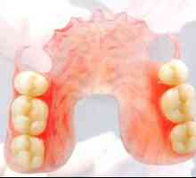 Stomatologie protetică: tipuri, descriere și prețuri pentru protezele dentare
