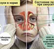 Psihosomaticul răcelii obișnuite, congestia nasului și sinuzita