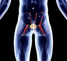 Cancerul vezicii urinare la bărbați: supraviețuirea în tratament