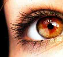 Soiuri de culoarea ochilor: chihlimbar, rosu, negru, verde