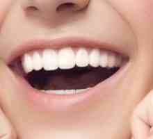 Remineralizarea dinților la domiciliu: indicații