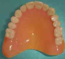 Protezare detașabilă cu absența completă a dinților