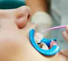 Argintarea dinților la copii: pentru și împotriva