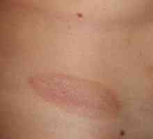 Scalp roșu pată pe corp: boli frecvente