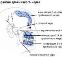 Simptomele inflamației nervului trigeminal
