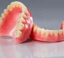 Proteză dentară detașabilă așa cum se întâmplă