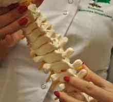 Scolioza coloanei vertebrale la adulți: simptome și tratament