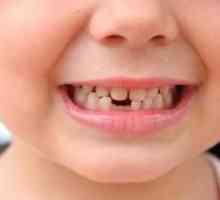 Cât de mulți dinți fac copiii?