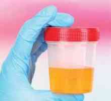 Sare oxalat în urina unui copil
