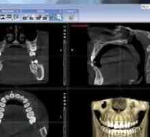 Trg în proiecția laterală a craniului, aplicație în stomatologie