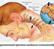 Exerciții pentru osteochondroza cervicală a coloanei vertebrale toracice