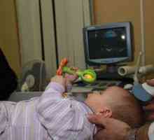 Creier ultrasunete la nou-născuți