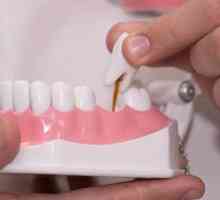 Opțiuni pentru înlocuirea dinților: înlocuirea opțiunilor dinților pentru proteze