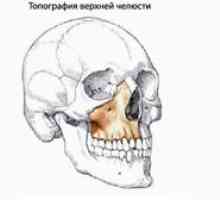 Maxilar maxilar: structura maxilarului superior, patologie, defecte
