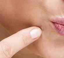 Tipuri și metode de tratament a fibromului pielii