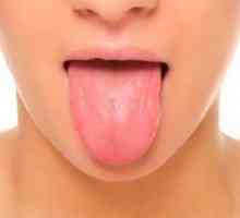 Blisterele de pe limbă sunt mai aproape de gât: blistere de pe rădăcină și vezicule