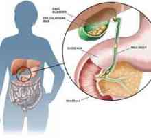 Staza biliară: simptome, tratamentul bolilor vezicii biliare