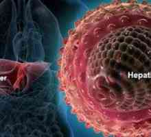 Este icterul un virus de ce fel de hepatită?