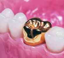 Dentiții de dinți - calitate stomatologică sau mauveton?