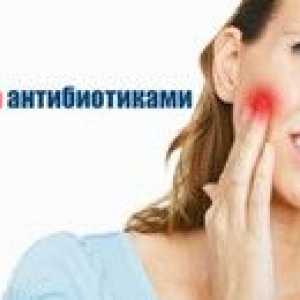 Antibiotic cu spumă de dinți la un adult