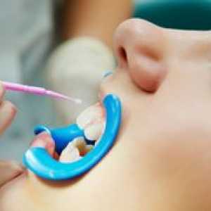 Ce este util pentru fluorizarea dinților?