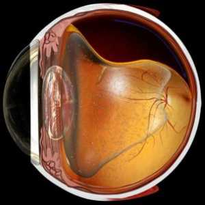 Ce este detașarea retinei: simptome și tratament