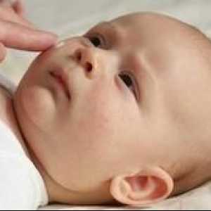 Ce trebuie să știți despre eritemul toxic la nou-născuți