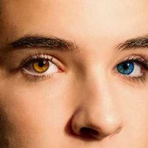 Heterochromia la om - motivele apariției, cum să se îmbolnăvească în mod intenționat