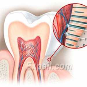 Hyperesthesia smalțului dintelui: cauze, simptome și tratament