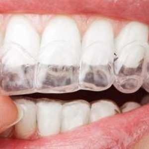 Eleneers pentru alinierea dinților: tipuri și descriere