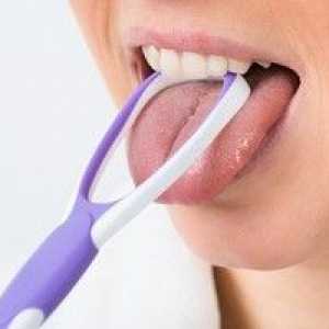 Cum să curățați limba și să îndepărtați placa: modalități de curățare