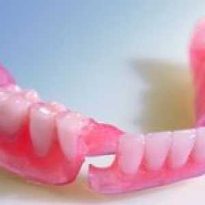 Cum sa alegi protezele dentare din nylon?