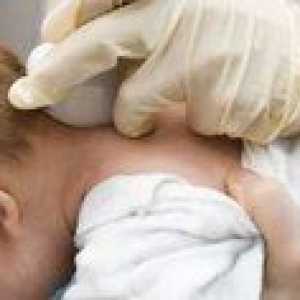 Chist în cap la nou-născuți: cauze și consecințe