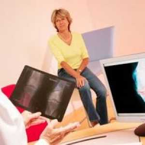 Tratamentul meniscului articulației genunchiului: simptome și cauze ale bolii