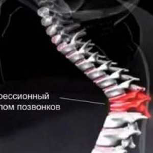 Tratamentul persoanelor vârstnice cu o fractură de compresie a coloanei vertebrale