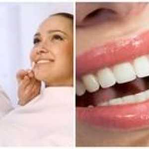 Albirea dintilor: avantajele si dezavantajele