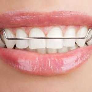 Plăci pentru alinierea dinților: placă ortodontică