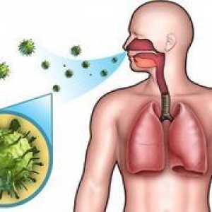 Pneumonie - inflamația plămânilor fără febră la adulți, simptome