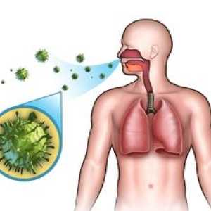 Pneumonie: contagioasă sau nu. Tipurile, agenții patogeni și modul în care sunt transmise