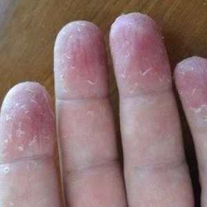De ce pielea de pe degete