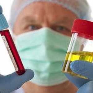 Apariția sângelui în urină a bărbaților. Cauze, simptome, tratament