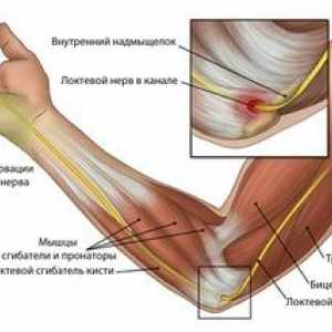 Cauza și tratamentul durerii în articulația cotului