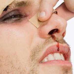 Semnele unui os nas rupt în persoana afectată